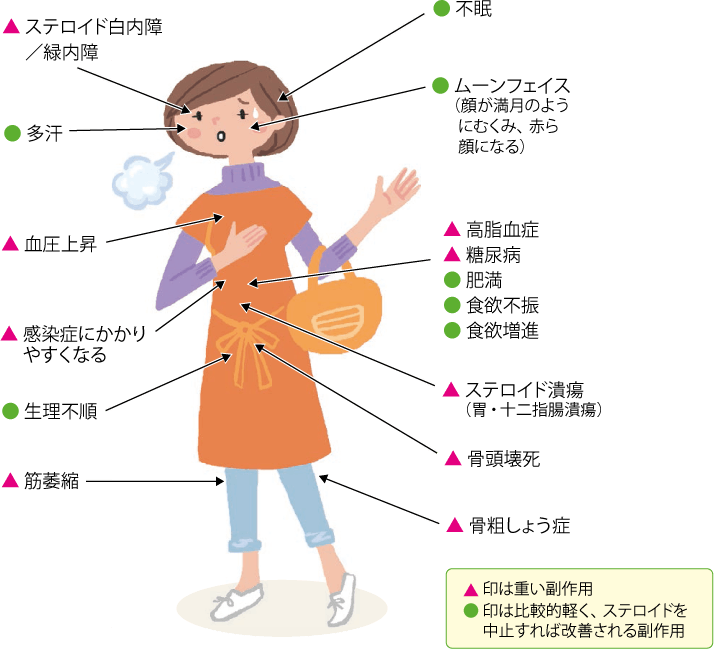 関節リウマチの薬物療法 リウマチ情報ポータル あゆみ製薬