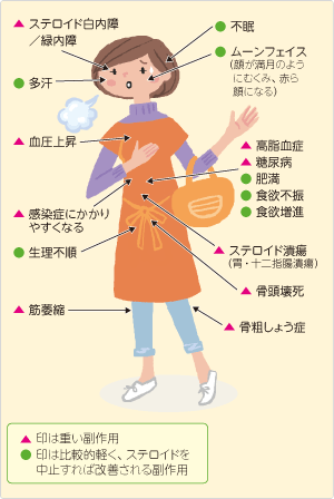 ステロイド離脱症候群   薬学用語解説   日本 